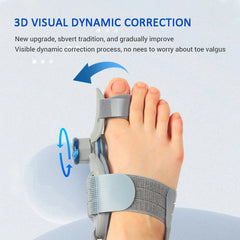 Bunion Corrector Toe Straightener Orthopedic Toe Separator, Unisex